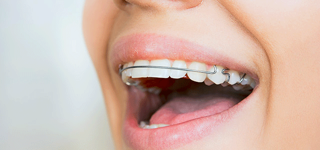 Những điều cần lưu ý khi dùng hàm duy trì