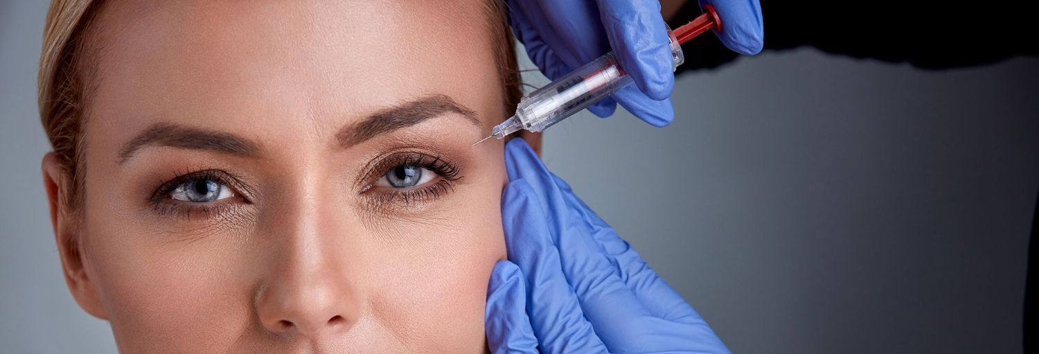 Tiêm botox xóa nếp nhăn chân chim đuôi mắt