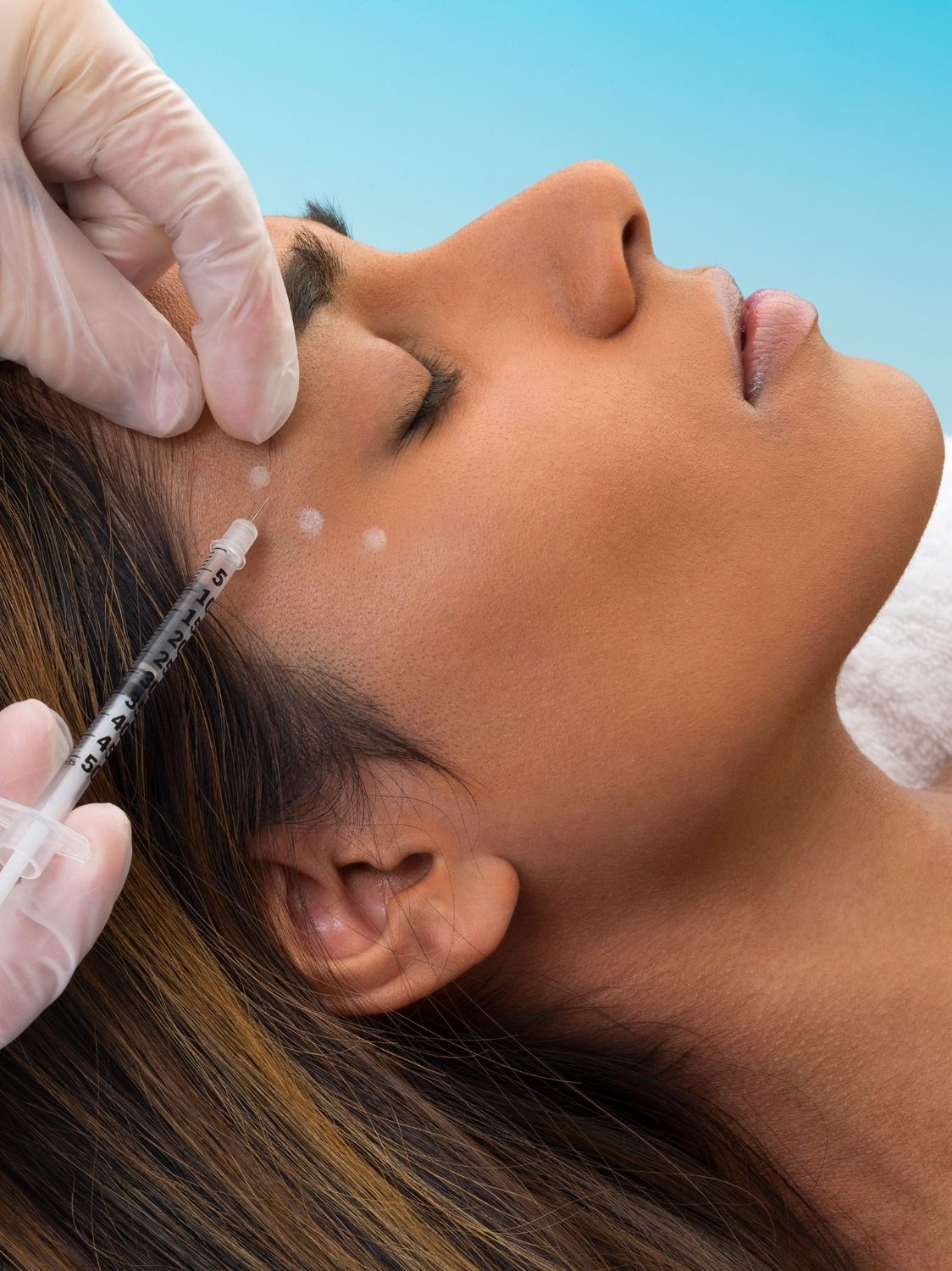 Các vấn đề có thể gặp phải sau tiêm botox xóa nếp chân chim đuôi mắt