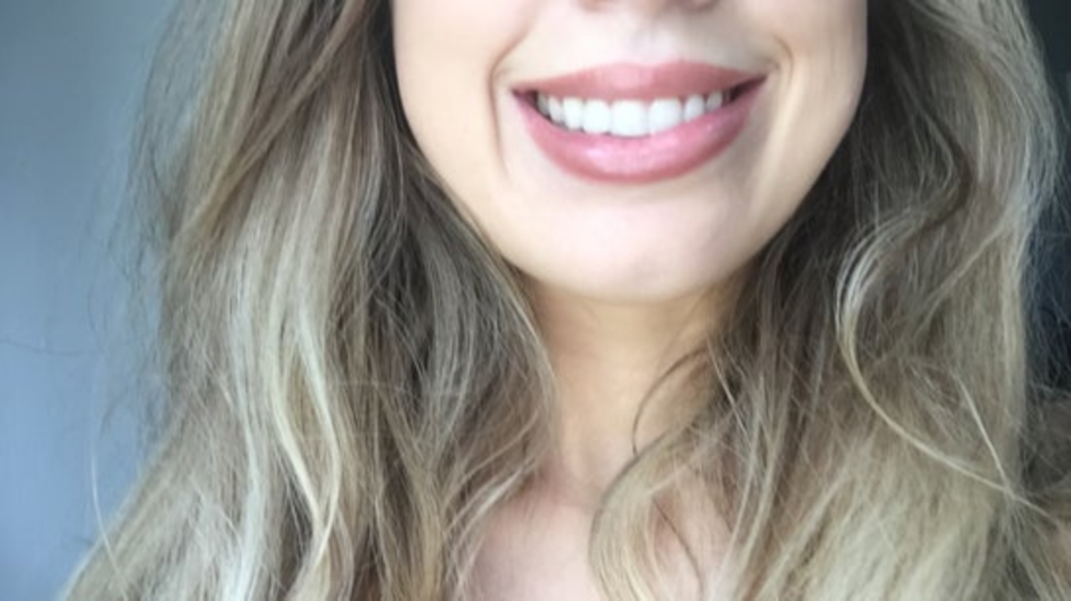 Cười lệch, cười không tự nhiên sau tiêm botox thon gọn hàm