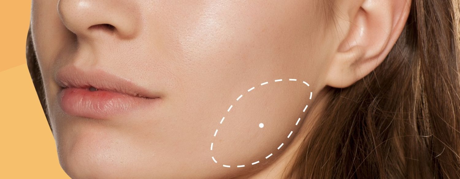Tổng hợp các vấn đề có thể xảy ra sau tiêm botox thon gọn hàm
