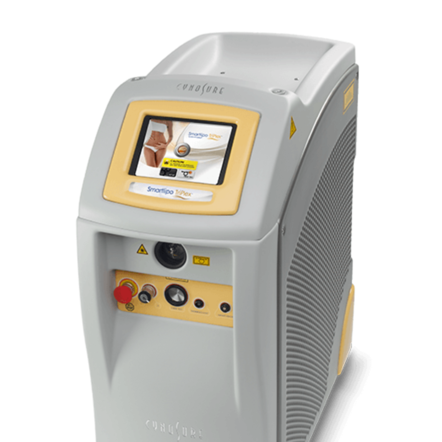 Hút mỡ công nghệ laser (Smartlipo, Slimlipo)