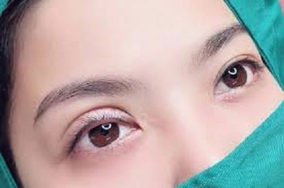 Những biến chứng sau phẫu thuật cắt mí