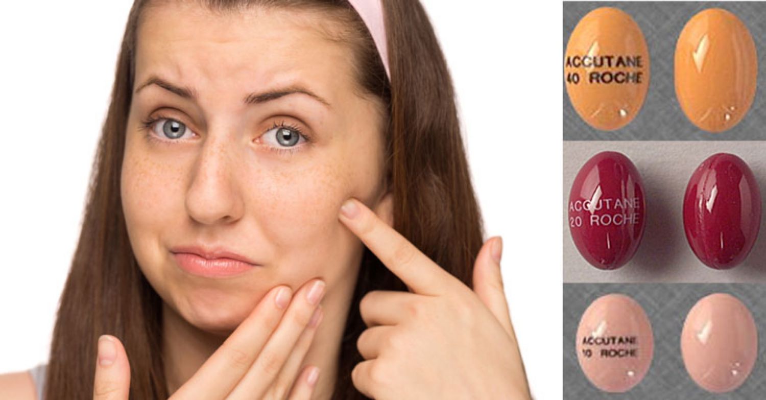 Khi dùng isotretinoin, nhiều chưa hẳn đã tốt