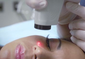 Laser và ánh sáng trong điều trị thẩm mỹ da - bài đọc chuyên sâu