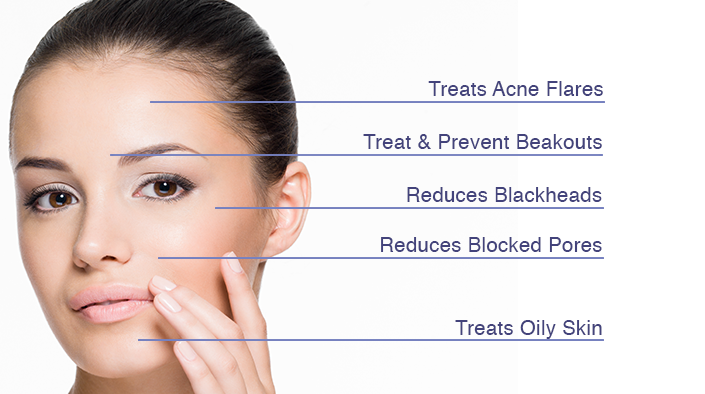 Lựa chọn các cách trị mụn phù hợp