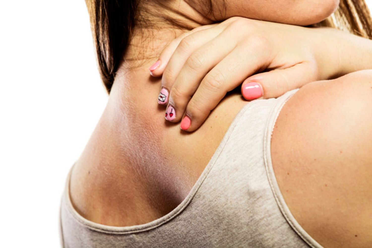 Mụn trứng cá và dị ứng da