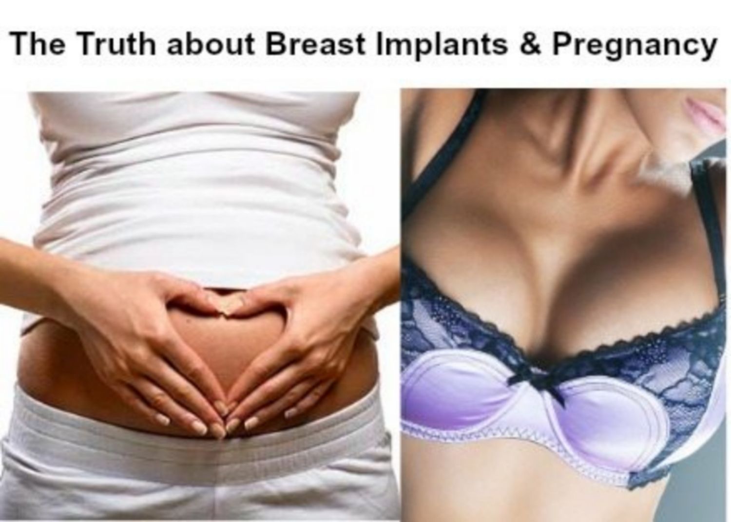 Trước hay sau khi sinh con: khi nào nên đặt túi độn ngực