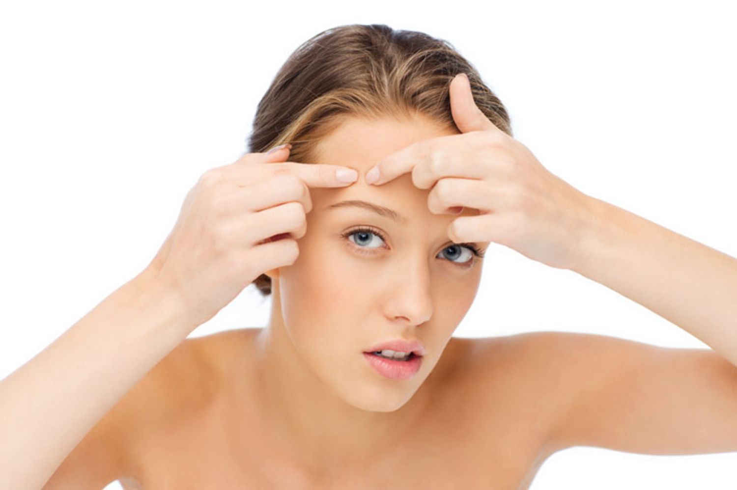 Nếu bạn có ý định nặn mụn, hãy đọc bài viết này