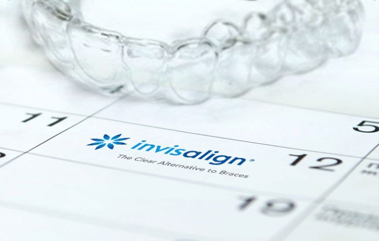 Niềng răng trong suốt invisalign mất bao lâu?