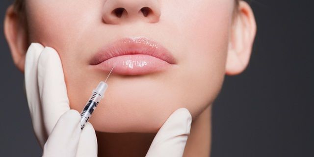 Nên chọn loại filler môi nào?