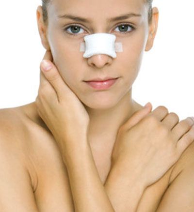 Sưng bầm và những bí quyết khắc phục sau nâng mũi