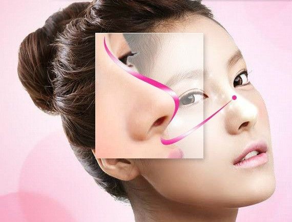 Hiểu rõ về kỹ thuật nâng mũi cấu trúc