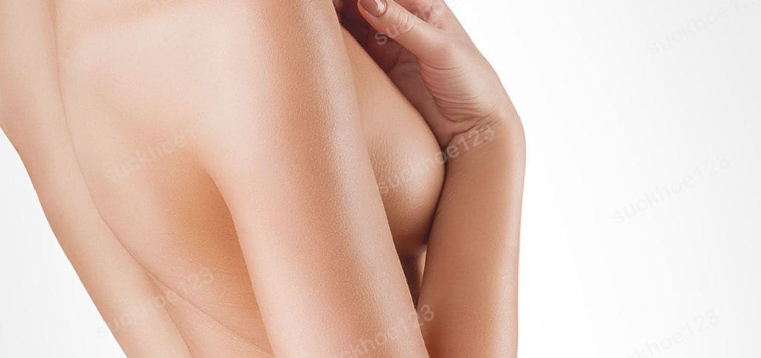 Khi nào cần kết hợp treo ngực sa trễ với nâng ngực bằng túi độn