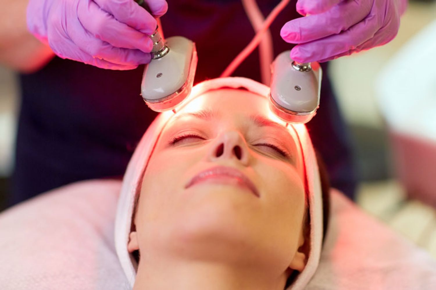 Trị mụn bằng ánh sáng và vị trí điều trị