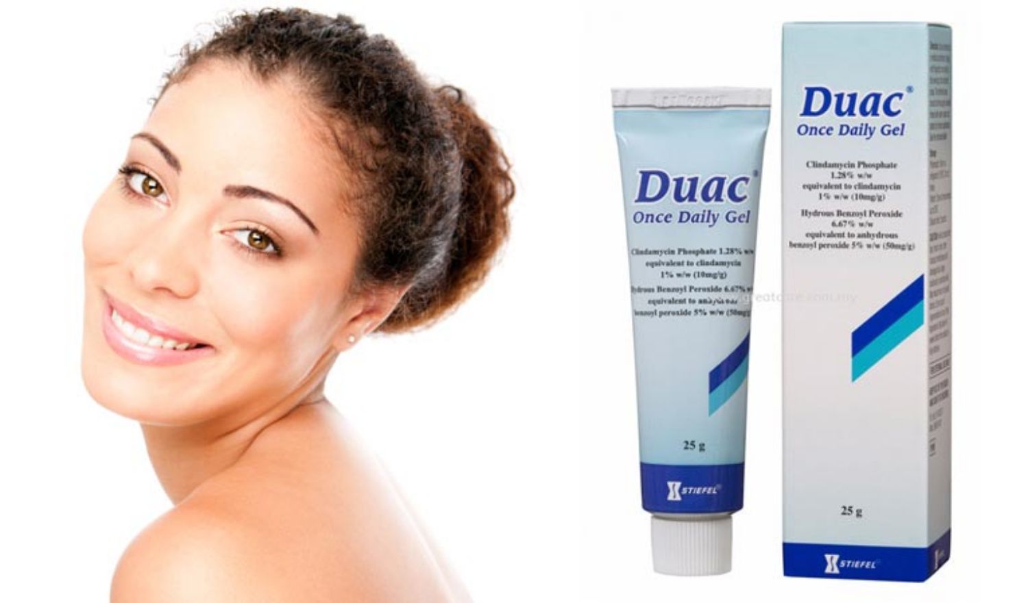 Trị mụn bằng kem kết hợp clindamycin và benzoyl peroxide