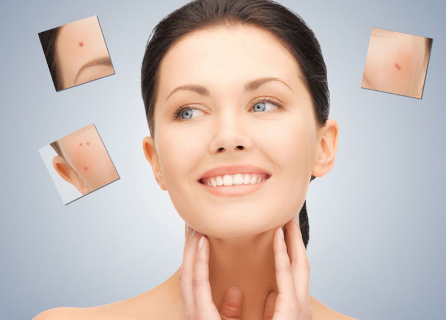 Trị mụn như thế nào là đúng cách?