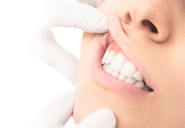 Tụt lợi: Nguyên nhân, điều trị và cách phòng ngừa