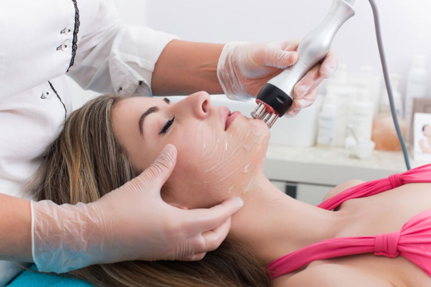 Ưu, nhược điểm của phương pháp trị mụn bằng tia laser
