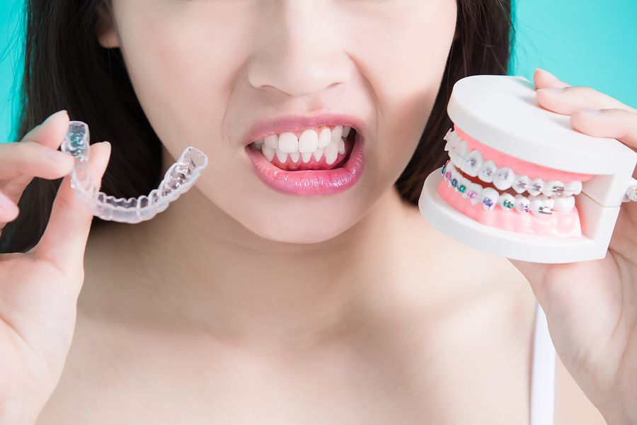 Phân biệt giữa khớp cắn chéo, khớp cắn sâu và khớp cắn ngược