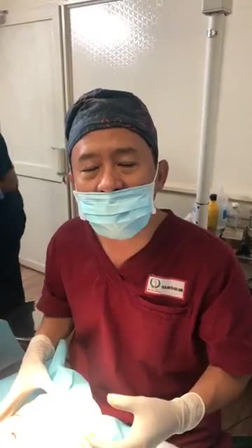 Cấy mỡ lên vùng thái dương