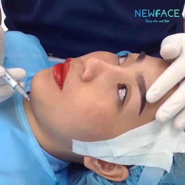 Chỉnh sửa mũi hỏng