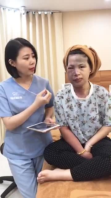Điều trị u máu và bớt sắc tố trên KH Đào Thu Yên