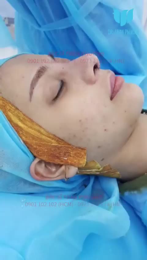May quá! Đã cứu được chiếc mũi của bạn ấy!