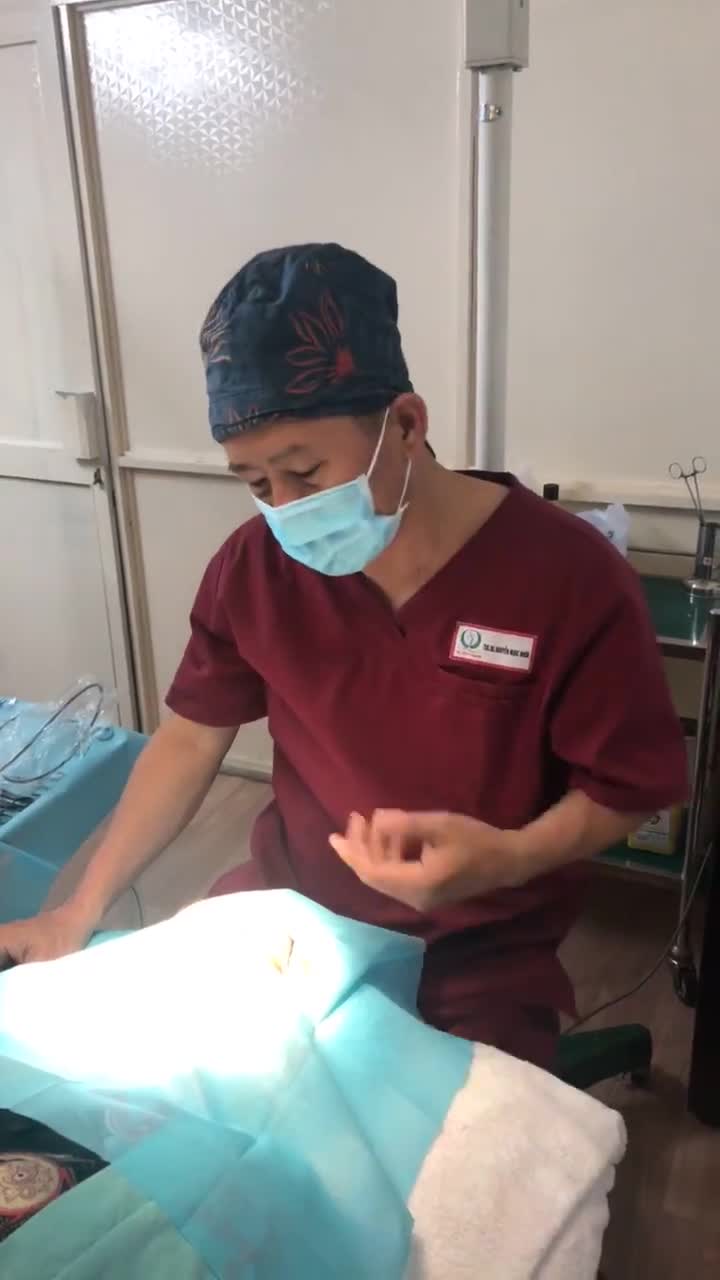 Treo mày trên KH đã từng cắt mắt, treo mày 1 lần