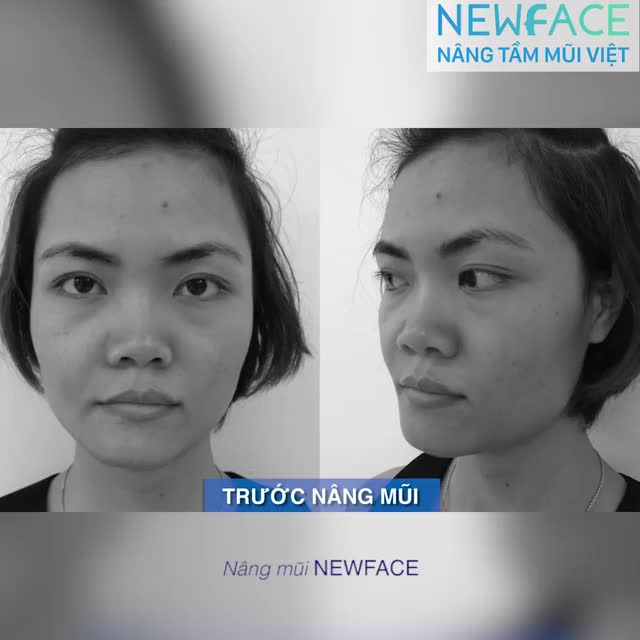 Một lần thay đổi nên đầu tư ở nơi tin cậy