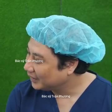 Phân tích trước nâng mũi cas KH Ái Trân