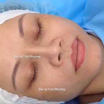 Chỉnh sửa mũi hỏng (p.1)
