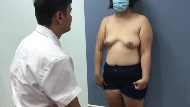 Tư vấn nâng ngực sa trễ