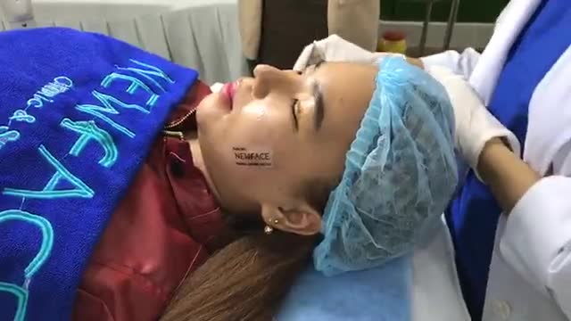 Cắt chỉ cho KH sử dụng dịch vụ nâng mũi cấu trúc và cắt mí mắt