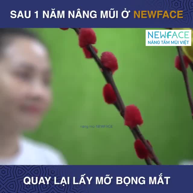 KH Minh Tím quay lại Newface sau 1 năm nâng mũi.