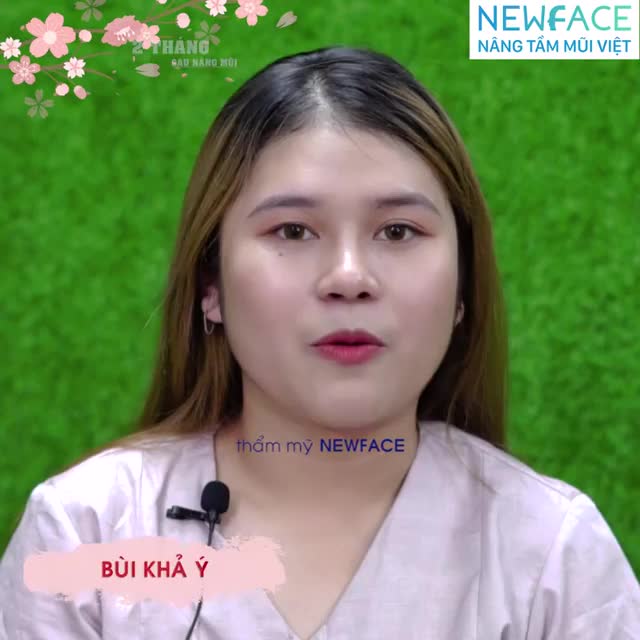 Gặp lại Khả Ý trong ngày tái khám sau 2 tháng nâng mũi