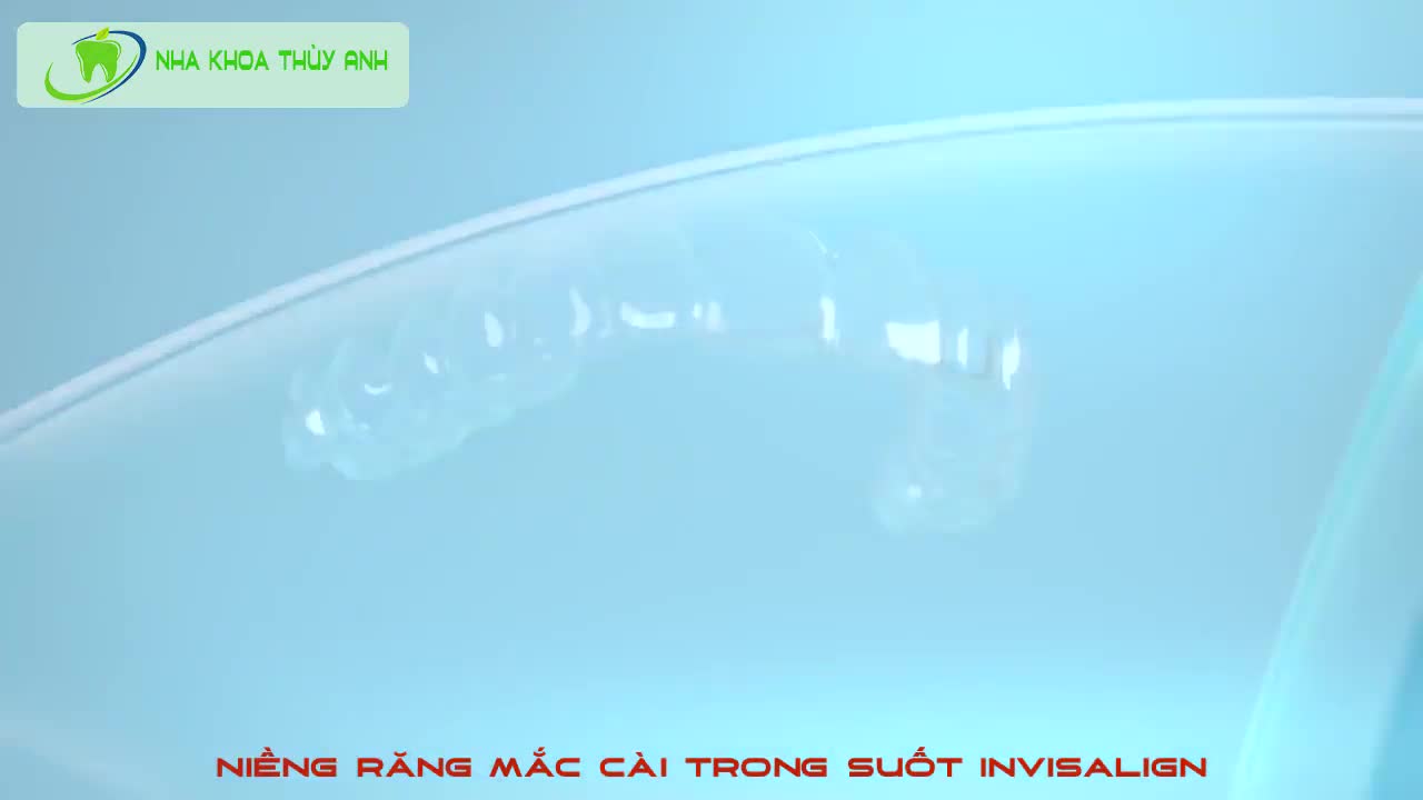 Niềng răng trong suốt Invisalign - Niềng răng không mắc cài
