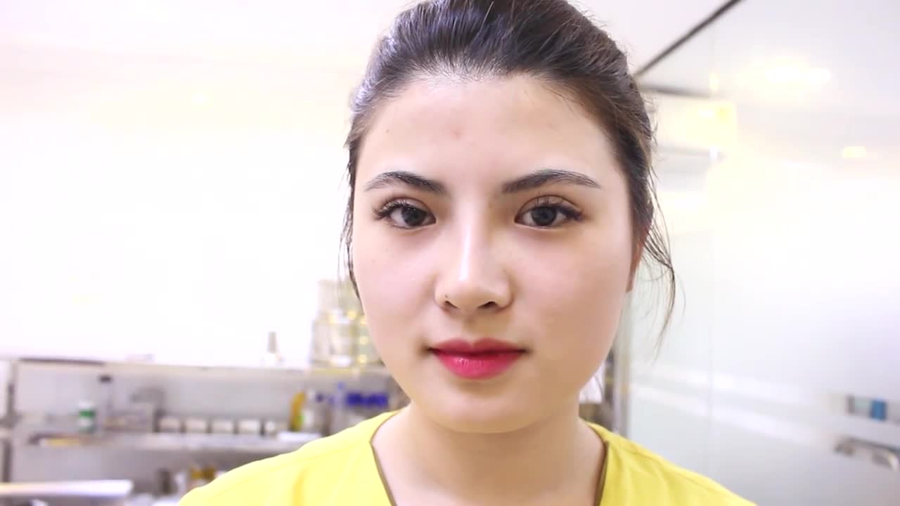 Cắt Mí Mani Mini Deep 10/03/2017 - VTM Y Khoa Dr.Hải Lê Ca 9