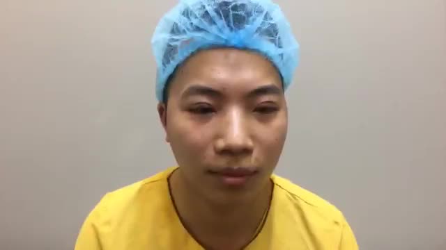 Cắt Mí Mắt Cho Nam Tại VTM Dr Hải Lê