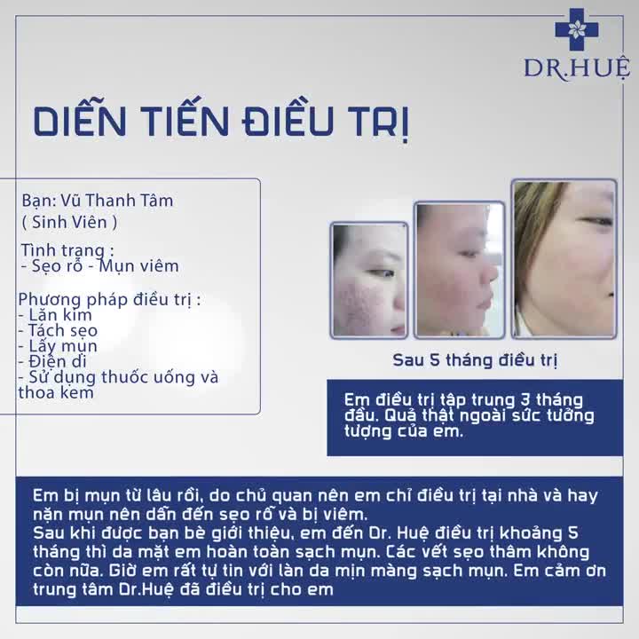 Diễn tiến điều trị- Vũ Thanh Tâm