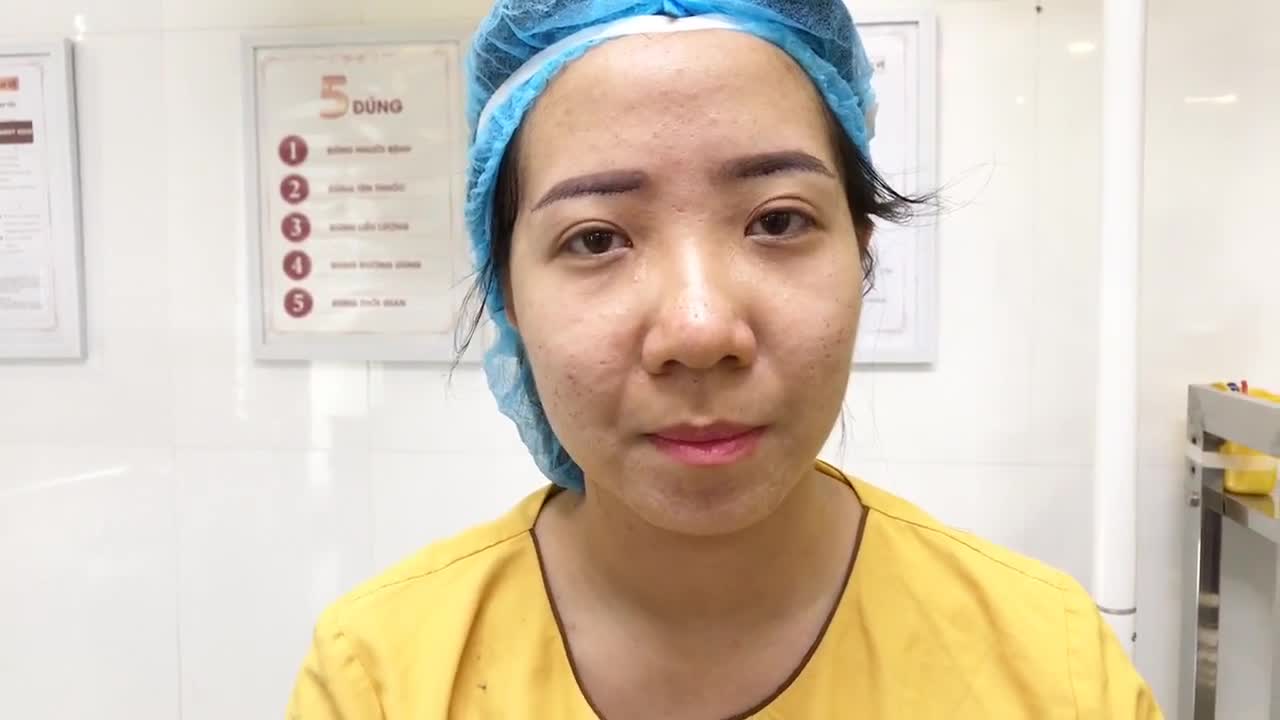 Hết Sụp Mí Hết Da Thừa Chỉ Với Thủ Thuật Nâng Cung Mày