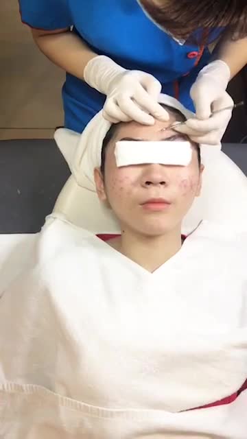 Trị mụn bằng công nghệ nano skin - Thẩm mỹ Kangnam - Ca 02
