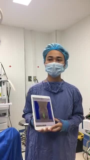 Lipo eo + Nâng mông bằng túi độn và mỡ tự thân - Thẩm mỹ Kangnam - Ca 02