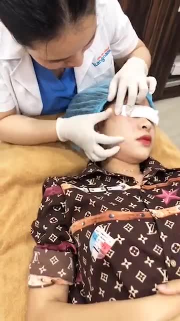 Trị tàn nhang - Thẩm mỹ Kangnam - Ca 07