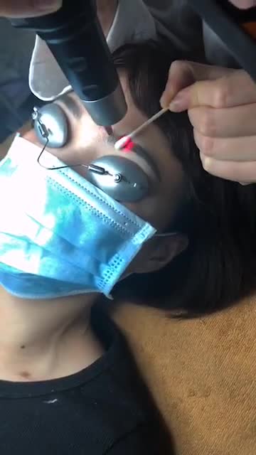 Xóa xăm lông mày - Thẩm mỹ Kangnam - Ca 07