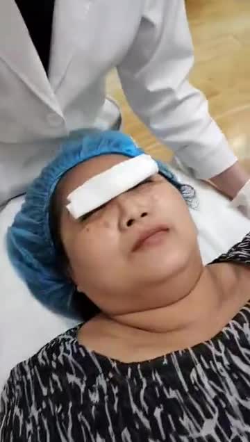 Trị tàn nhang bằng công nghệ Laser Picosure - Thẩm mỹ Kangnam - Ca 02