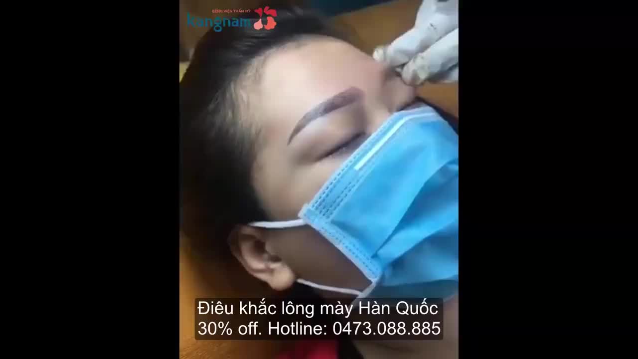 Điêu khắc chân mày - Thẩm mỹ Kangnam - Ca 05