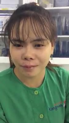 Tạo hình môi trái tim - Thẩm mỹ Kangnam - Ca 11