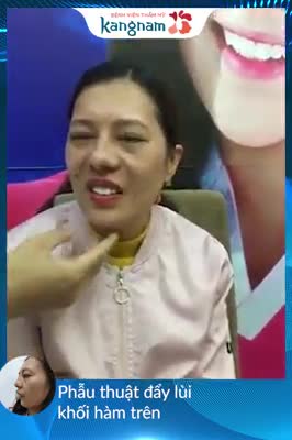 Phẫu thuật chỉnh hàm hô, răng vẩu ca khó - Thẩm mỹ Kangnam - Ca 02
