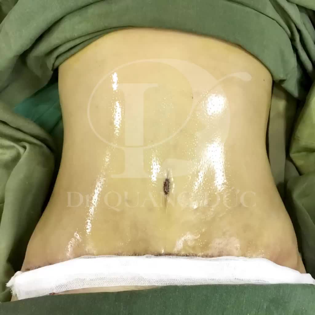 Tại sao phải "sống chung với lũ" khi bạn hoàn toàn có thể thay đổi - Dr Quang Đức